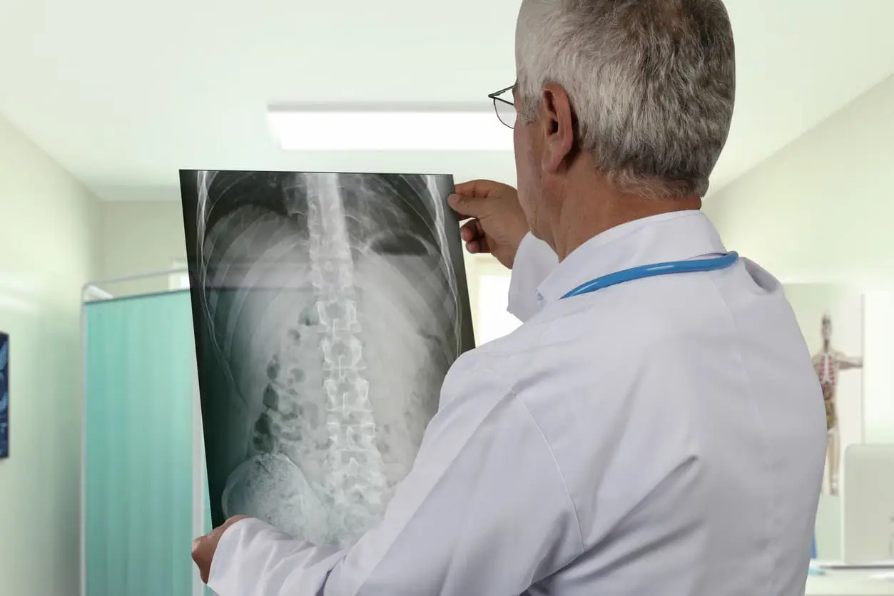 HOW MUCH THE INSURANCE CARRIER MUST PAY FOR THE WORKER’S SERIOUS INJURIES HOW MUCH THE INSURANCE CARRIER MUST PAY FOR THE WORKER’S SERIOUS INJURIES