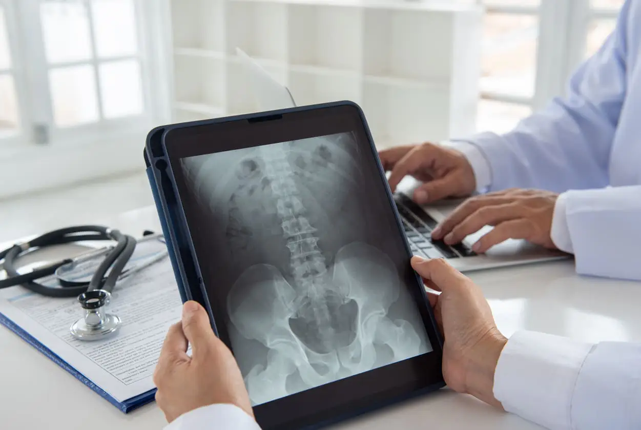 WHAT ARE THE POSSIBLE COSTS OF A SERIOUS BACK INJURY WHAT ARE THE POSSIBLE COSTS OF A SERIOUS BACK INJURY