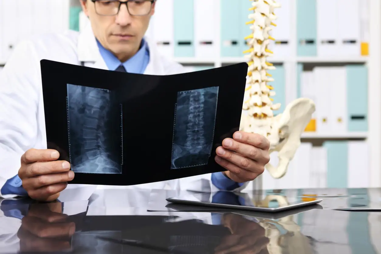 WHAT IS THE AVERAGE SETTLEMENT FOR A SERIOUS LOWER BACK PAIN IN A CAR ACCIDENT AFTER SURGERY WHAT IS THE AVERAGE SETTLEMENT FOR A SERIOUS LOWER BACK PAIN IN A CAR ACCIDENT AFTER SURGERY